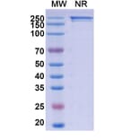 SDS-PAGE - Sibrotuzumab Biosimilar - Anti-FAP Antibody - BSA and Azide free (A338850) - Antibodies.com