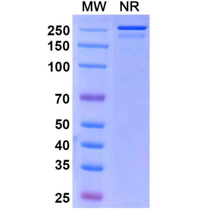 SDS-PAGE - Sirtratumab Biosimilar - Anti-SLITRK6 Antibody - BSA and Azide free (A338853) - Antibodies.com