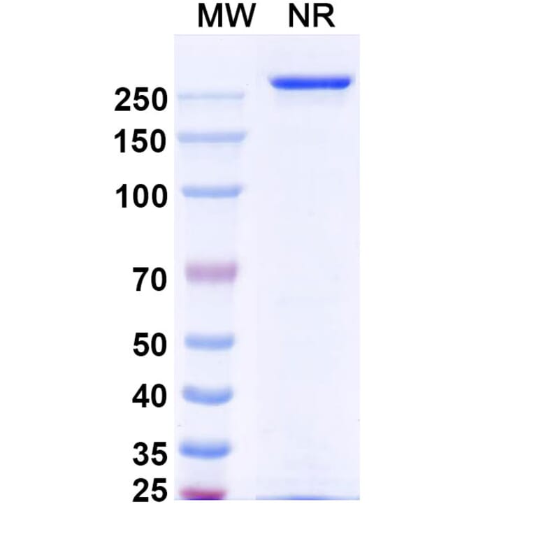 SDS-PAGE - Vandortuzumab Biosimilar - Anti-STEAP1 Antibody - BSA and Azide free (A338856) - Antibodies.com
