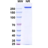 SDS-PAGE - Vandortuzumab Biosimilar - Anti-STEAP1 Antibody - BSA and Azide free (A338856) - Antibodies.com
