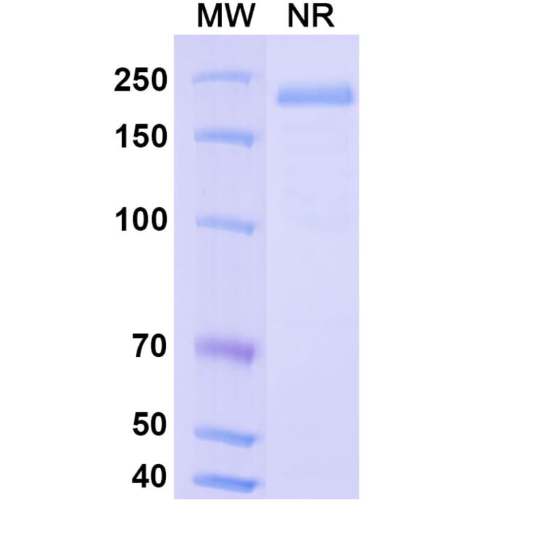 SDS-PAGE - Vantictumab Biosimilar - Anti-FZD1 Antibody - BSA and Azide free (A338857) - Antibodies.com