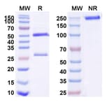 SDS-PAGE - Zelminemab Biosimilar - Anti-ADCYAP1R1 Antibody - BSA and Azide free (A338859) - Antibodies.com