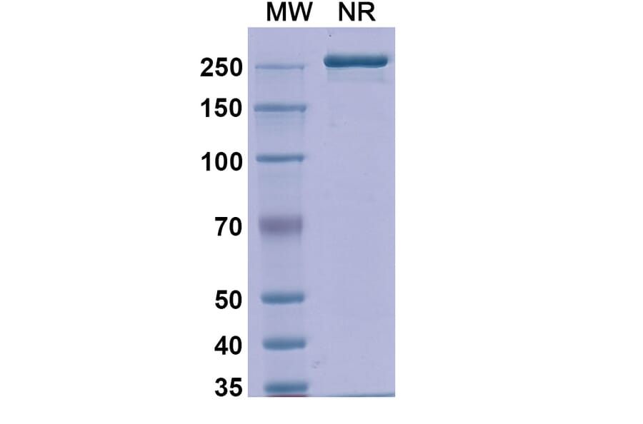 SDS-PAGE - Detumomab Biosimilar - Anti-CD20 Antibody - BSA and Azide free (A338869) - Antibodies.com