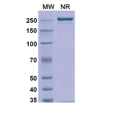 SDS-PAGE - Detumomab Biosimilar - Anti-CD20 Antibody - BSA and Azide free (A338869) - Antibodies.com
