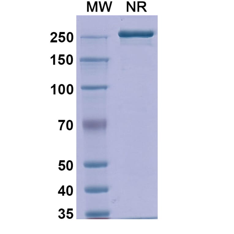 SDS-PAGE - Detumomab Biosimilar - Anti-CD20 Antibody - BSA and Azide free (A338869) - Antibodies.com