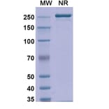 SDS-PAGE - Detumomab Biosimilar - Anti-CD20 Antibody - BSA and Azide free (A338869) - Antibodies.com