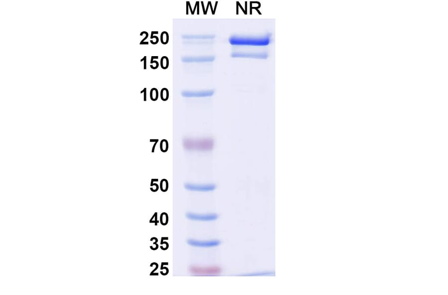 SDS-PAGE - Detumomab Biosimilar - Anti-CD20 Antibody - BSA and Azide free (A338869) - Antibodies.com