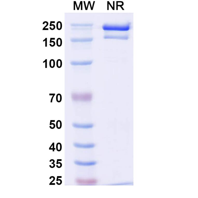 SDS-PAGE - Detumomab Biosimilar - Anti-CD20 Antibody - BSA and Azide free (A338869) - Antibodies.com
