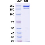 SDS-PAGE - Detumomab Biosimilar - Anti-CD20 Antibody - BSA and Azide free (A338869) - Antibodies.com