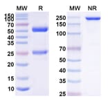 SDS-PAGE - Derlotuximab Biosimilar - Anti-Histone H1 Antibody - BSA and Azide free (A338874) - Antibodies.com