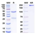 SDS-PAGE - Casirivimab Biosimilar - Anti-SARS-CoV-2 Spike Protein RBD Antibody - BSA and Azide free (A338902) - Antibodies.com