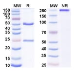 SDS-PAGE - Imdevimab Biosimilar - Anti-SARS-CoV-2 Spike Protein RBD Antibody - BSA and Azide free (A338903) - Antibodies.com