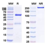 SDS-PAGE - Etesevimab Biosimilar - Anti-SARS-CoV-2 Spike Protein RBD Antibody - BSA and Azide free (A338904) - Antibodies.com