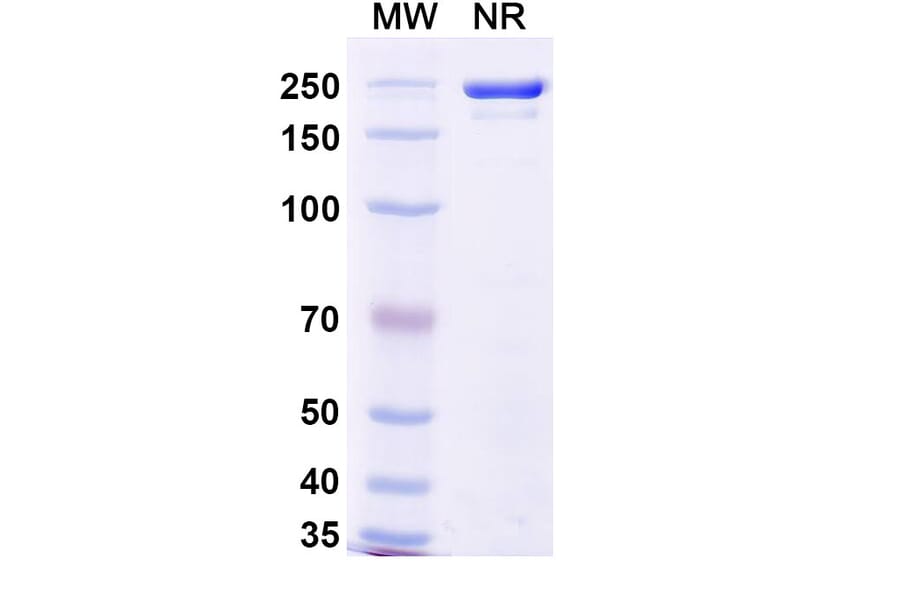 SDS-PAGE - Sotrovimab Biosimilar - Anti-SARS-CoV-2 Spike Protein RBD Antibody - BSA and Azide free (A338905) - Antibodies.com