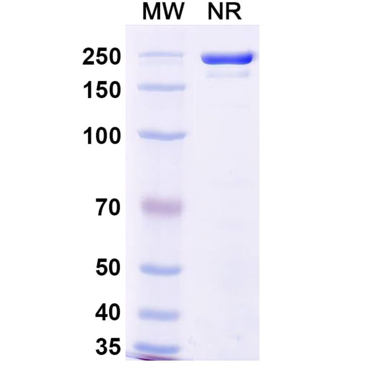 SDS-PAGE - Sotrovimab Biosimilar - Anti-SARS-CoV-2 Spike Protein RBD Antibody - BSA and Azide free (A338905) - Antibodies.com