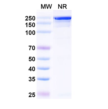 SDS-PAGE - Diridavumab Biosimilar - Anti-Hemagglutinin Antibody - BSA and Azide free (A338915) - Antibodies.com