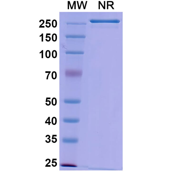 SDS-PAGE - Gedivumab Biosimilar - Anti-Hemagglutinin Antibody - BSA and Azide free (A338918) - Antibodies.com