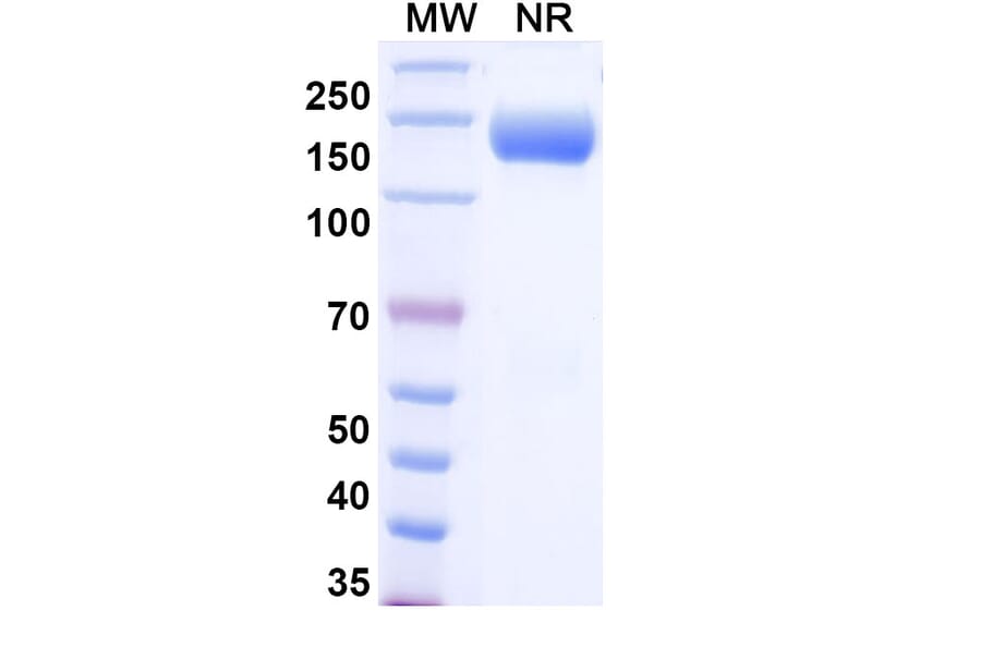 SDS-PAGE - Aflibercept Biosimilar - Anti-VEGFA Antibody - BSA and Azide free (A338935) - Antibodies.com