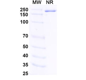 SDS-PAGE - Fabrazyme Biosimilar - Anti-alpha Galactosidase A Antibody - BSA and Azide free (A338938) - Antibodies.com