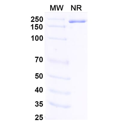SDS-PAGE - Fabrazyme Biosimilar - Anti-alpha Galactosidase A Antibody - BSA and Azide free (A338938) - Antibodies.com
