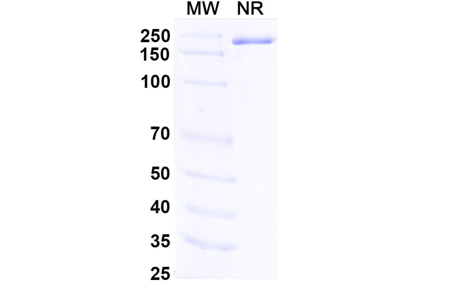 SDS-PAGE - Fabrazyme Biosimilar - Anti-alpha Galactosidase A Antibody - BSA and Azide free (A338938) - Antibodies.com