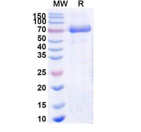 SDS-PAGE - Naglazyme Biosimilar - Anti-ARSB Antibody - BSA and Azide free (A338939) - Antibodies.com