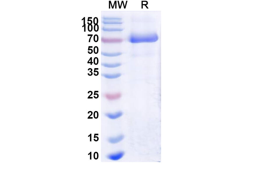SDS-PAGE - Naglazyme Biosimilar - Anti-ARSB Antibody - BSA and Azide free (A338939) - Antibodies.com