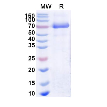 SDS-PAGE - Naglazyme Biosimilar - Anti-ARSB Antibody - BSA and Azide free (A338939) - Antibodies.com