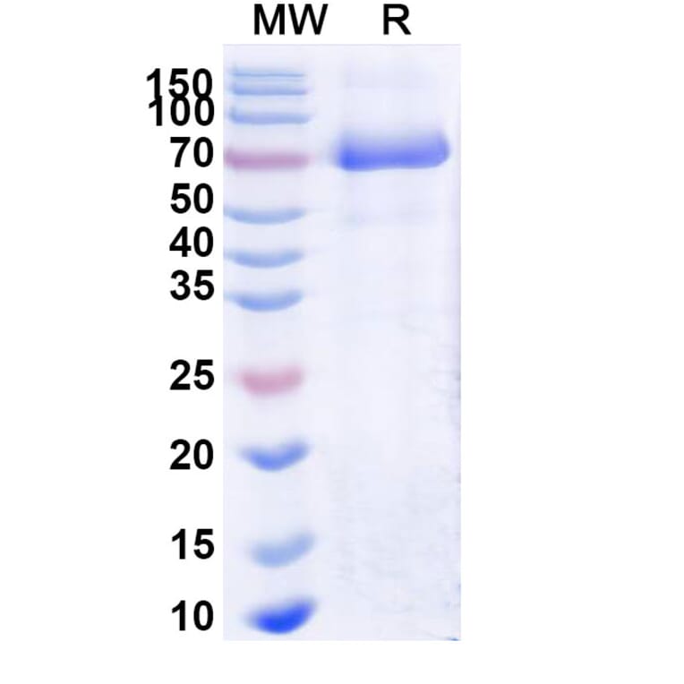 SDS-PAGE - Naglazyme Biosimilar - Anti-ARSB Antibody - BSA and Azide free (A338939) - Antibodies.com