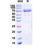 SDS-PAGE - Naglazyme Biosimilar - Anti-ARSB Antibody - BSA and Azide free (A338939) - Antibodies.com