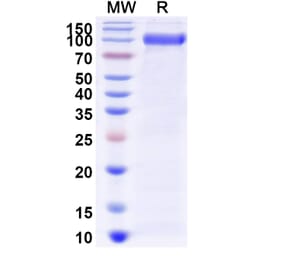 SDS-PAGE - Myozyme Biosimilar - Anti-GAA Antibody - BSA and Azide free (A338940) - Antibodies.com
