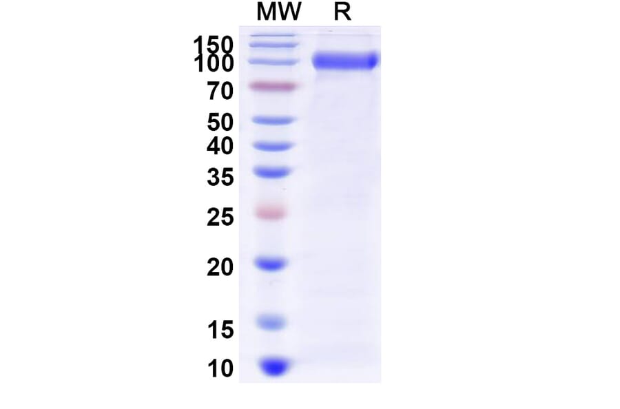 SDS-PAGE - Myozyme Biosimilar - Anti-GAA Antibody - BSA and Azide free (A338940) - Antibodies.com