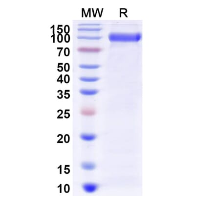 SDS-PAGE - Myozyme Biosimilar - Anti-GAA Antibody - BSA and Azide free (A338940) - Antibodies.com