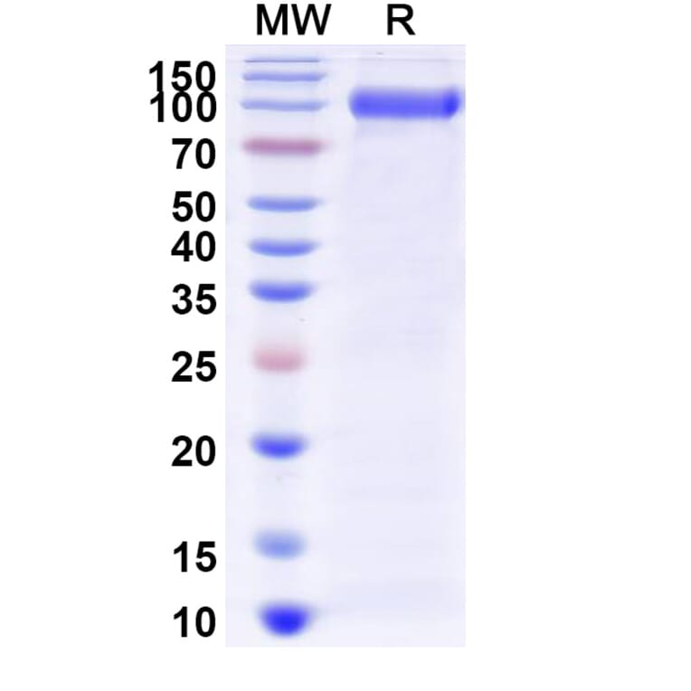 SDS-PAGE - Myozyme Biosimilar - Anti-GAA Antibody - BSA and Azide free (A338940) - Antibodies.com