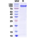 SDS-PAGE - Myozyme Biosimilar - Anti-GAA Antibody - BSA and Azide free (A338940) - Antibodies.com