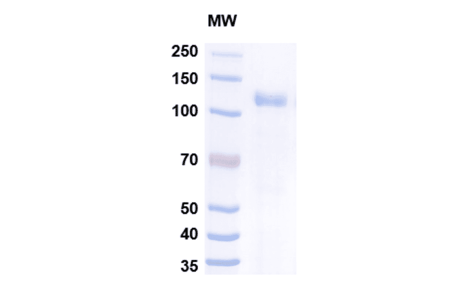 SDS-PAGE - Myozyme Biosimilar - Anti-GAA Antibody - BSA and Azide free (A338940) - Antibodies.com