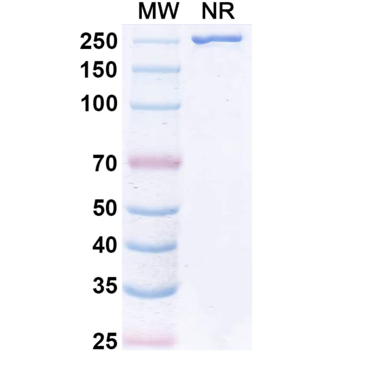 SDS-PAGE - VAK-694 Biosimilar - Anti-IL-4 Antibody - BSA and Azide free (A338942) - Antibodies.com