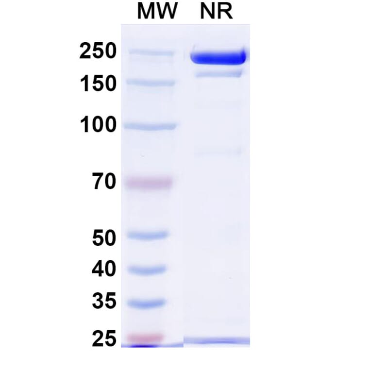 SDS-PAGE - STRO-001 Biosimilar - Anti-CD74 Antibody - BSA and Azide free (A338951) - Antibodies.com