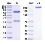 SDS-PAGE - Capromab Biosimilar - Anti-PSMA Antibody - BSA and Azide free (A338960) - Antibodies.com