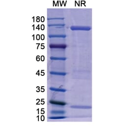 SDS-PAGE - Basiliximab Biosimilar - Anti-CD25 Antibody - BSA and Azide free (A338961) - Antibodies.com