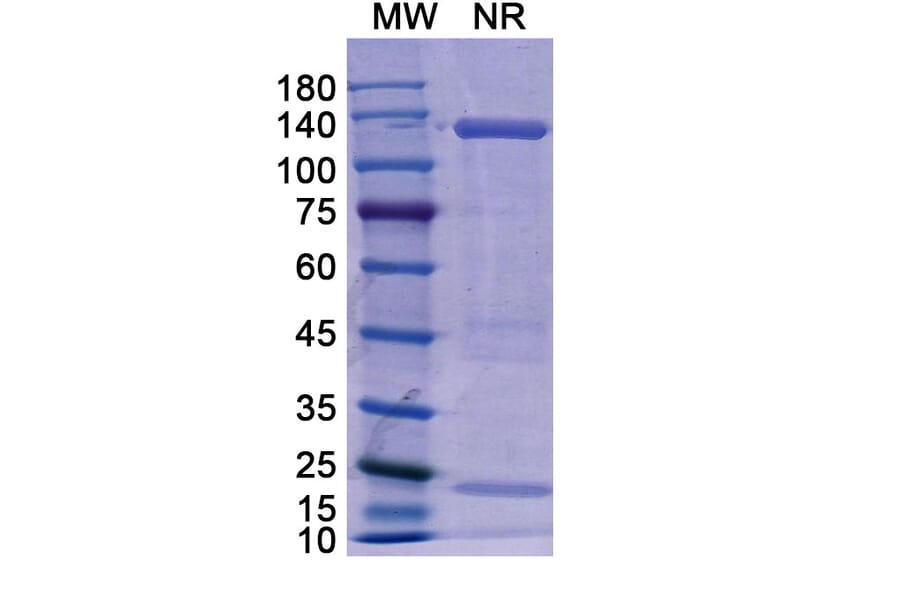 SDS-PAGE - Basiliximab Biosimilar - Anti-CD25 Antibody - BSA and Azide free (A338961) - Antibodies.com