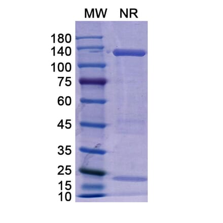 SDS-PAGE - Basiliximab Biosimilar - Anti-CD25 Antibody - BSA and Azide free (A338961) - Antibodies.com