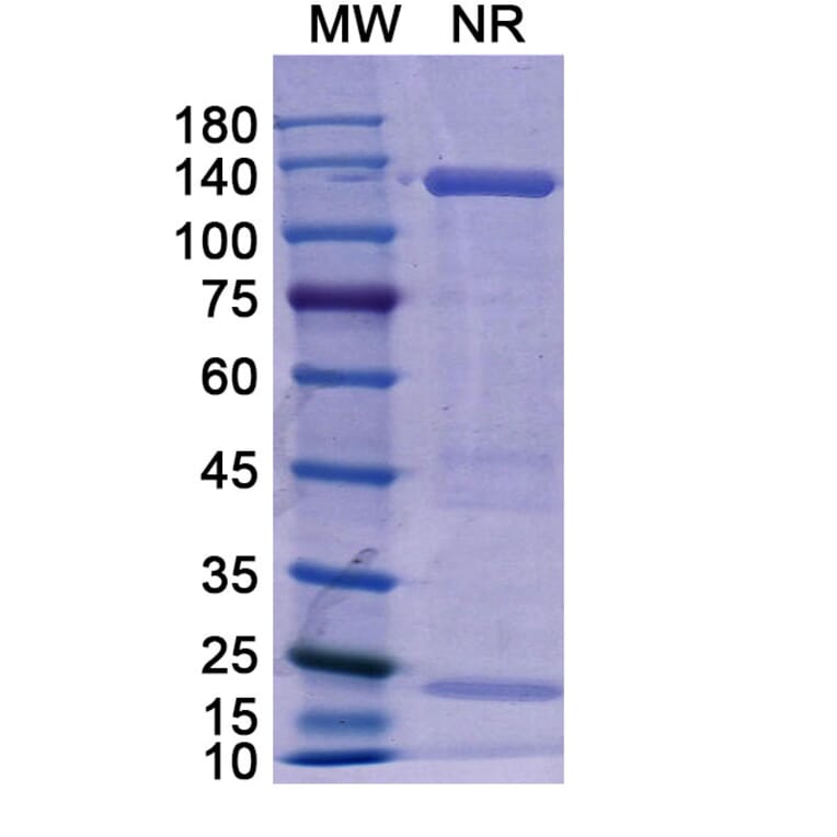 SDS-PAGE - Basiliximab Biosimilar - Anti-CD25 Antibody - BSA and Azide free (A338961) - Antibodies.com