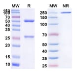 SDS-PAGE - Daclizumab Biosimilar - Anti-CD25 Antibody - BSA and Azide free (A338962) - Antibodies.com