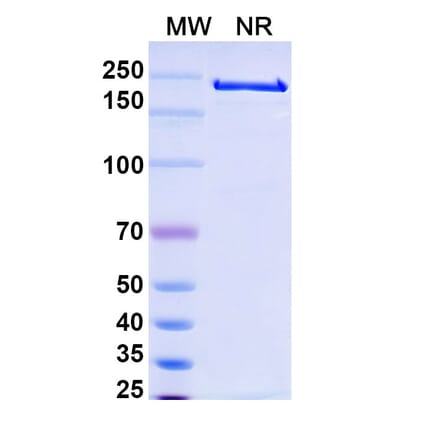SDS-PAGE - Alemtuzumab Biosimilar - Anti-CD52 Antibody - BSA and Azide free (A338965) - Antibodies.com