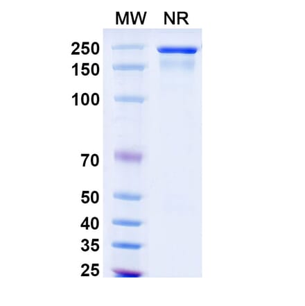 SDS-PAGE - Omalizumab Biosimilar - Anti-IgE Antibody - BSA and Azide free (A338967) - Antibodies.com