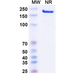 SDS-PAGE - Canakinumab Biosimilar - Anti-IL-1 beta Antibody - BSA and Azide free (A338974) - Antibodies.com