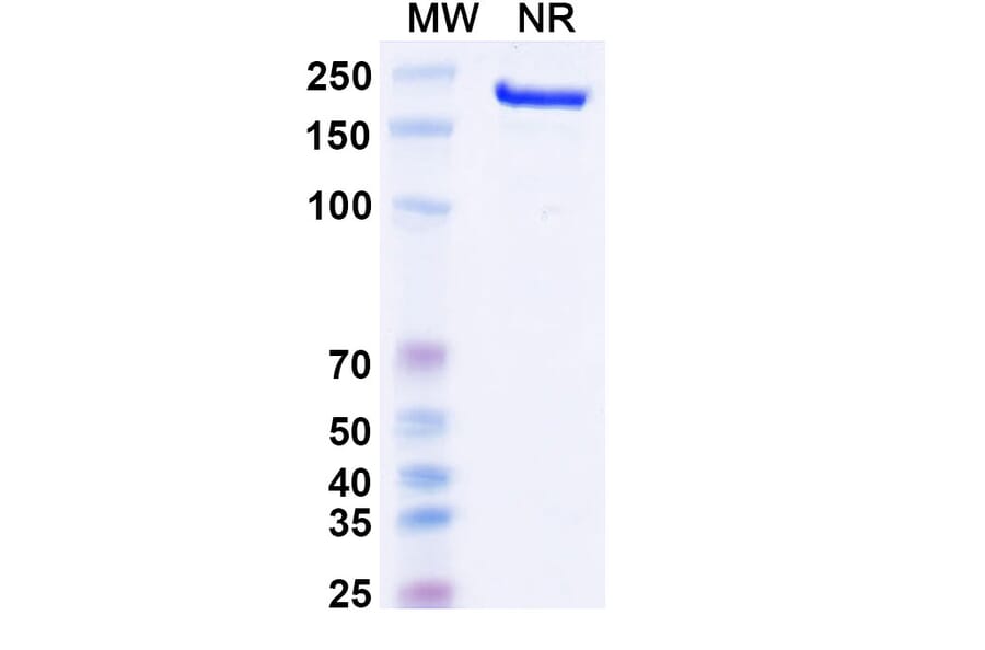 SDS-PAGE - Canakinumab Biosimilar - Anti-IL-1 beta Antibody - BSA and Azide free (A338974) - Antibodies.com