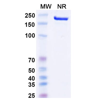 SDS-PAGE - Canakinumab Biosimilar - Anti-IL-1 beta Antibody - BSA and Azide free (A338974) - Antibodies.com