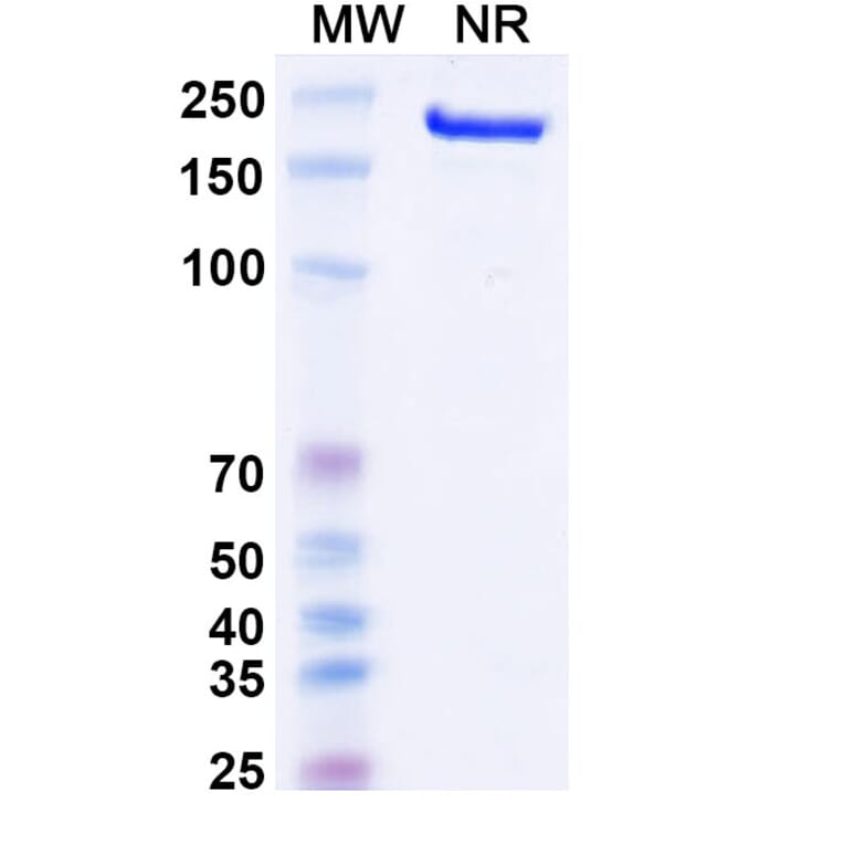 SDS-PAGE - Canakinumab Biosimilar - Anti-IL-1 beta Antibody - BSA and Azide free (A338974) - Antibodies.com